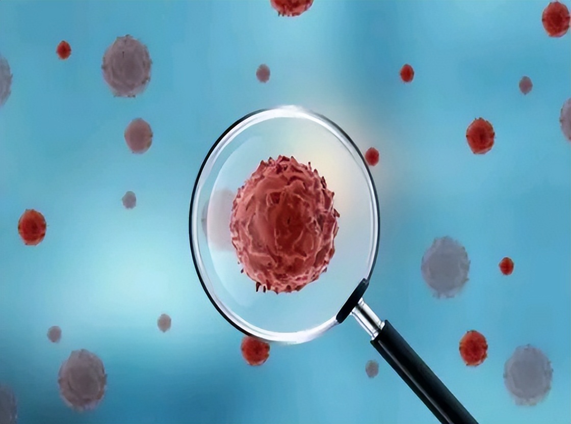 慢性炎症患者怎样预防癌变,慢性炎症诱发肿瘤