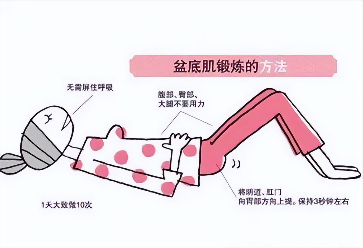 顺产后盆底康复方法,盆底康复凯格尔运动