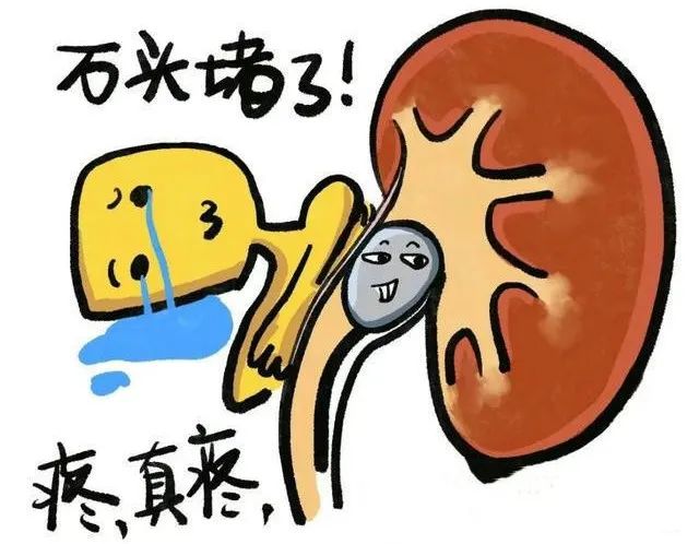 别让万物复苏的时节，成为尿路结石的“春天”！