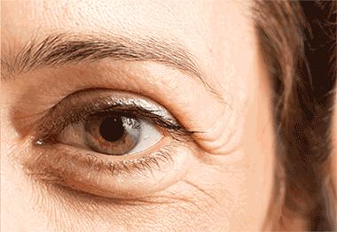 方脸和高颧骨怎么抗老,高颧骨好看还是低颧骨抗老