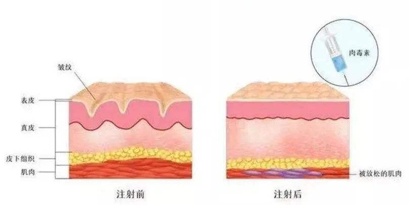 变态整容失败案例,变态整容医生为女儿报仇