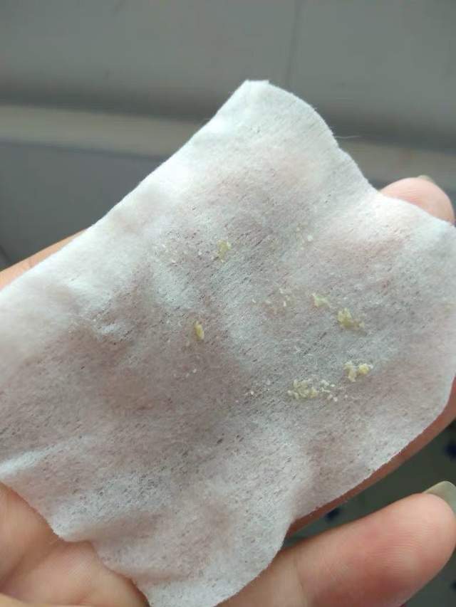 真黑头假黑头傻傻分不清楚，怎么去黑头？