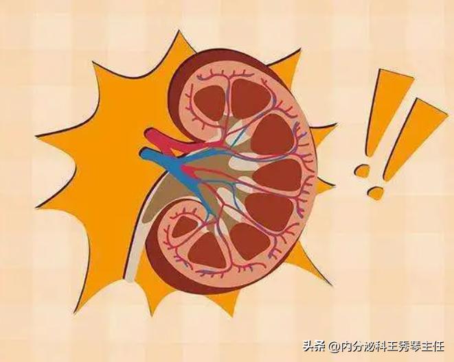 急性肾炎会变成尿毒症吗,急性肾炎症状表现有哪些