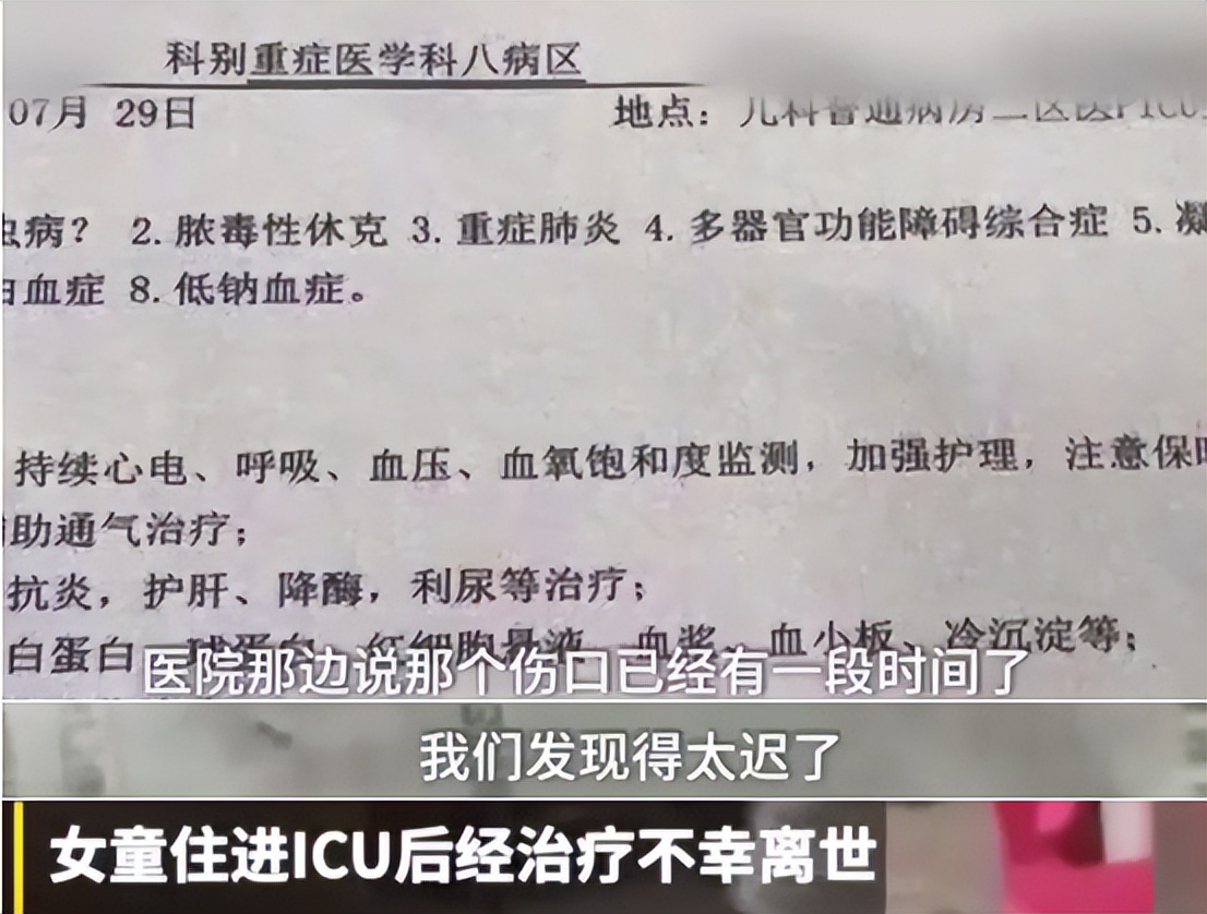 恙虫到底有多可怕？致死率极高