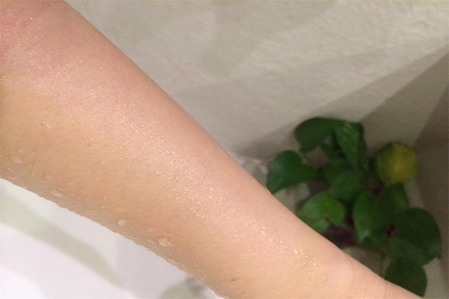 秋冬季皮肤干痒掉屑,冬天皮肤干燥发痒掉屑怎么改善