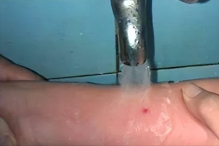 蜜蜂为什么蜇人后会死,蜜蜂为什么蜇人会死