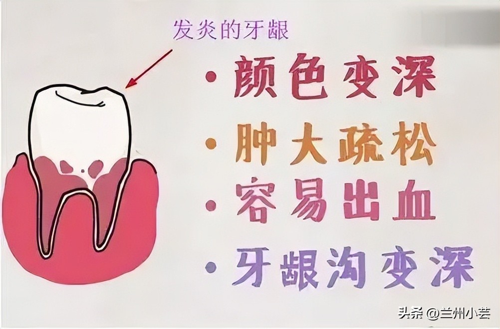 牙疼要人命怎么根治,牙疼要人命是有说法的