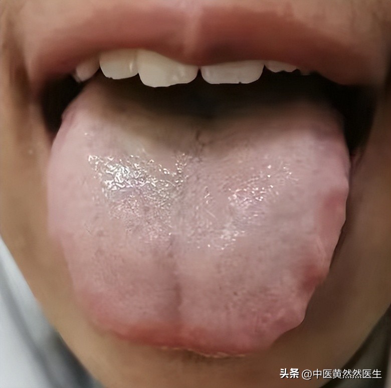 治疗脾肾阳虚最经典的方子,治脾肾阳虚最好的方子