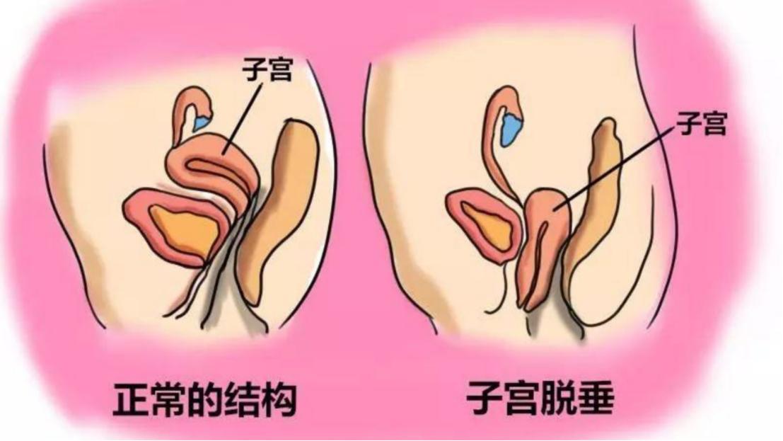 注意！性功能障碍不仅困扰男性，多数女性有苦说不出，该如何应对