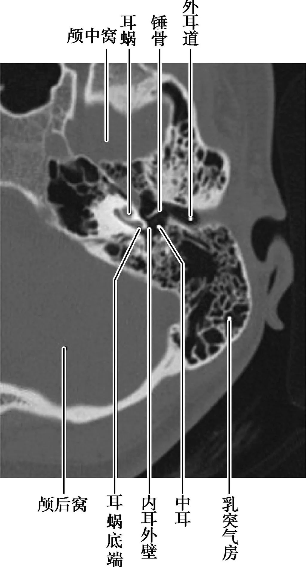 耳部解剖结构和生理功能,耳部解剖笔记