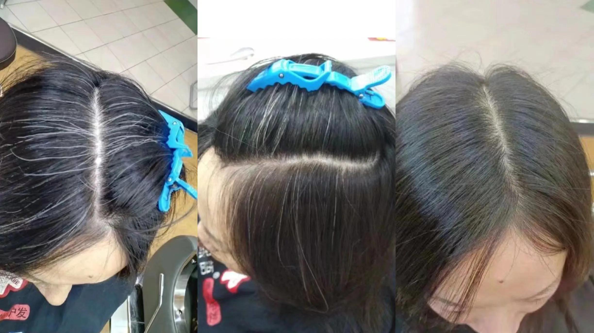 染发过程中头皮刺痛正常吗,染发过程中头皮痒正常吗