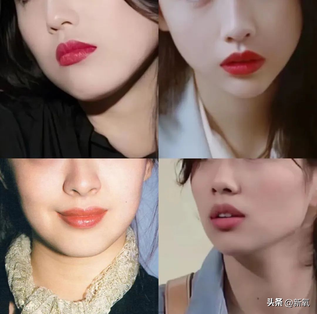 嘴唇薄变丰满,嘴唇变凸变丑怎么办