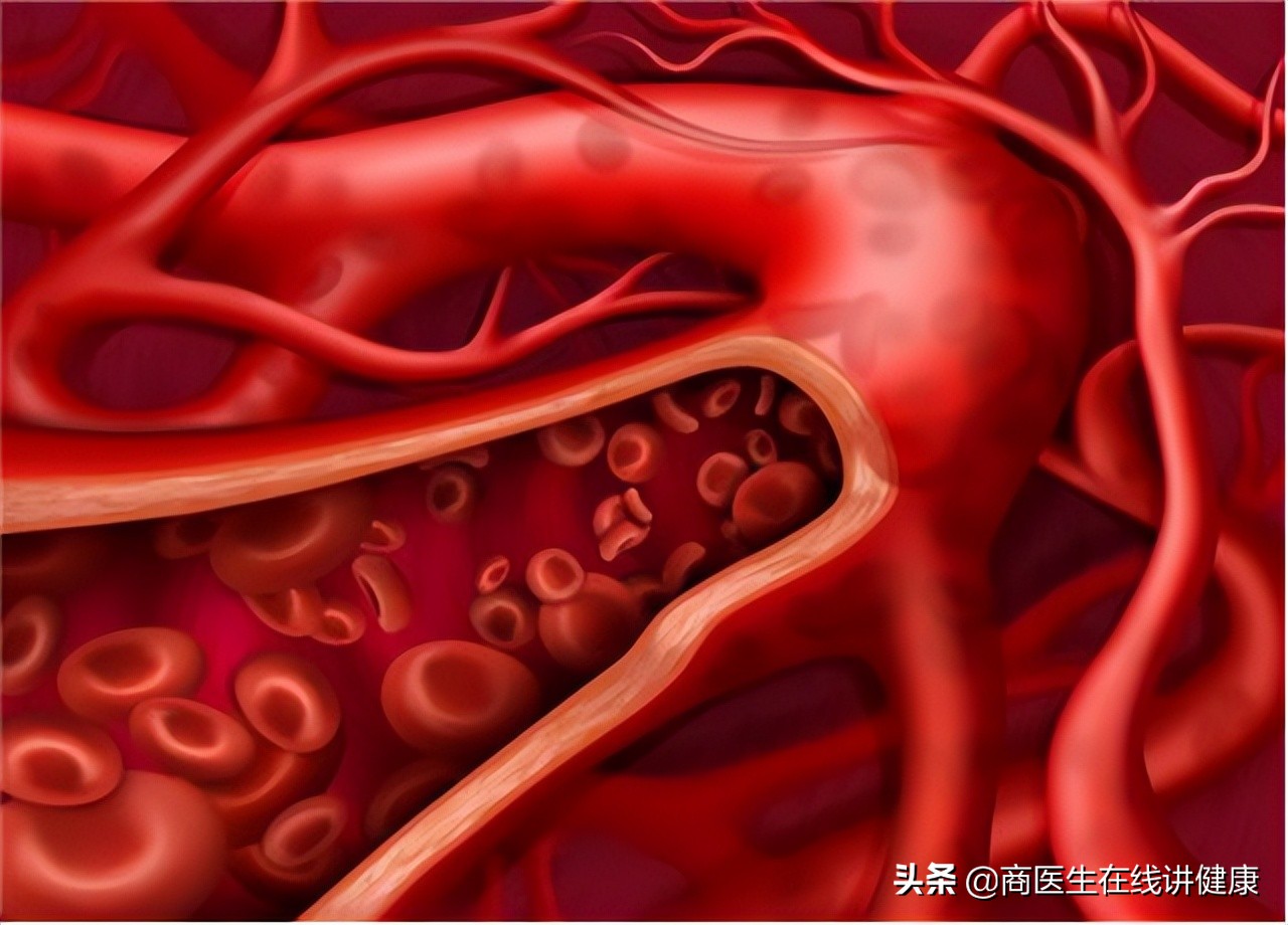 降血糖的特效药达格列净,糖尿病降糖药达格列净