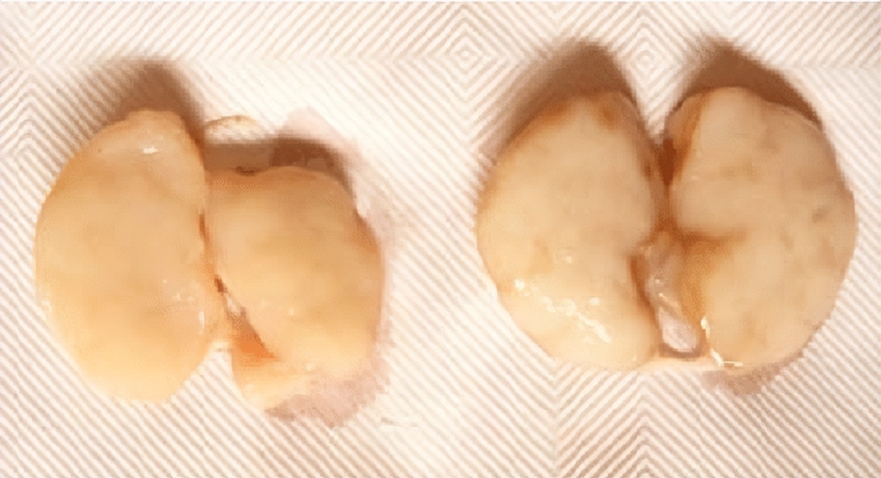 猪的乳头肉可以吃么,猪的乳头肉能吃吗