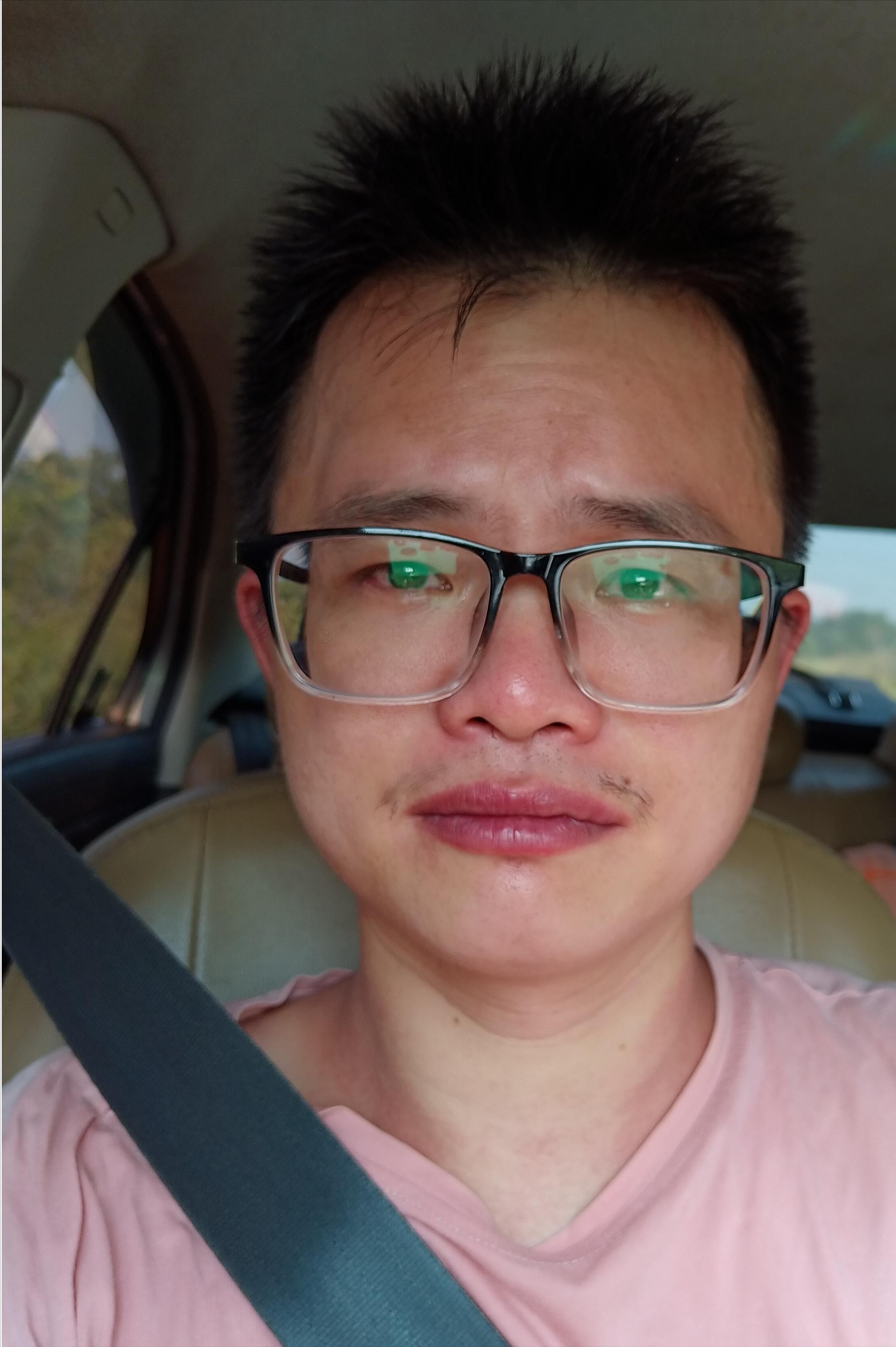 第一次被蜜蜂蛰是怎样的感觉,额头被蜜蜂蛰了没什么大的感觉