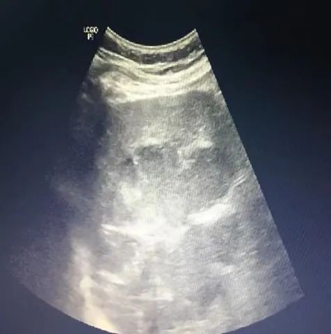 反复发热与什么有关,反复发热是什么病的前兆