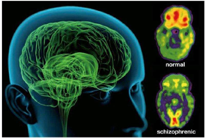 焦虑的父亲，最终为精分儿子选择手术治疗