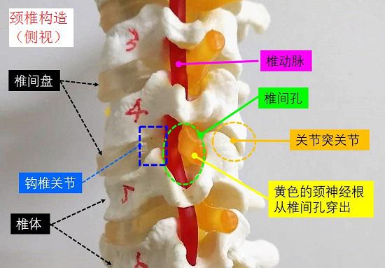 颈椎间盘突出的治疗方法有哪些,颈4567椎间盘向后突出能治愈吗