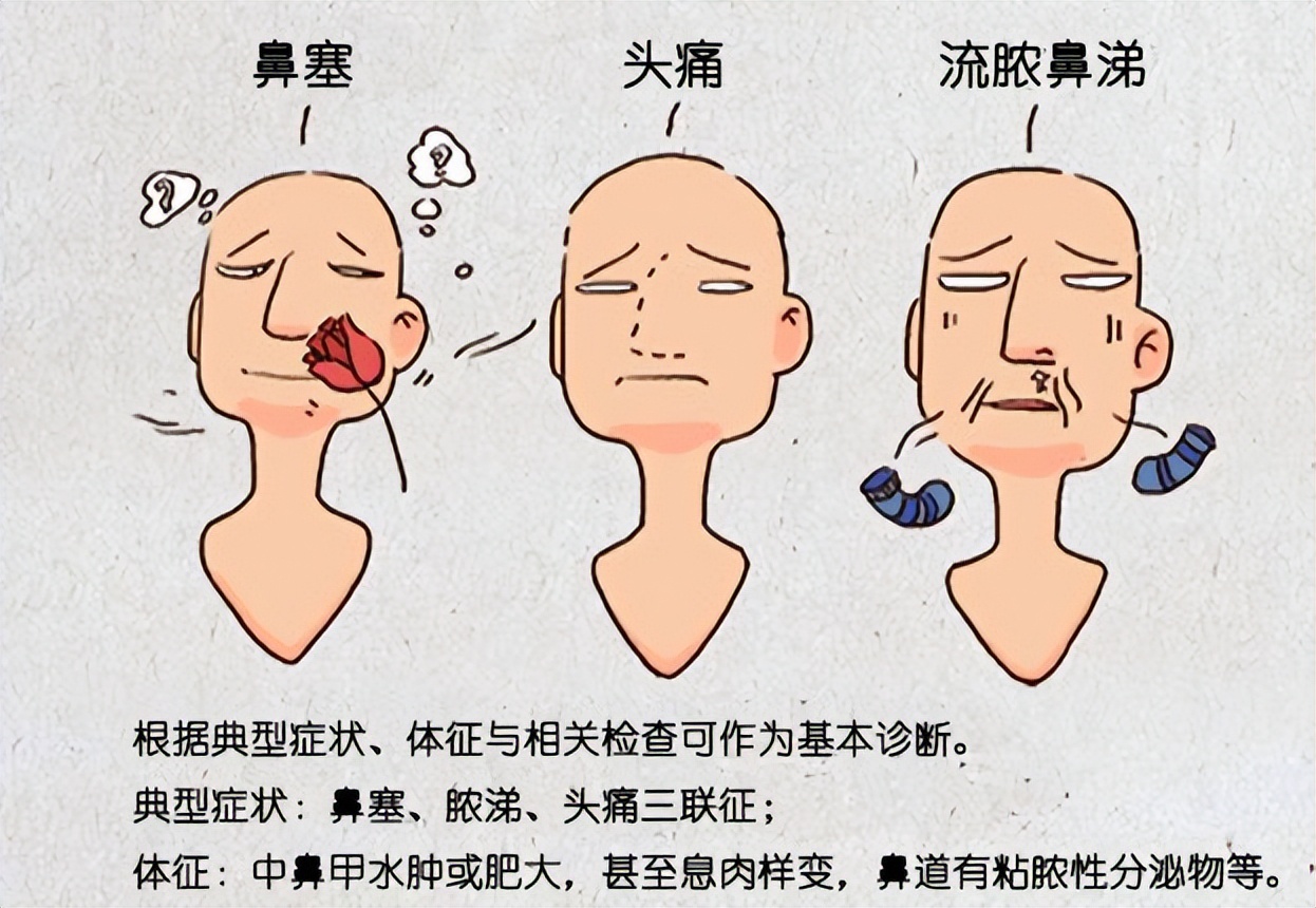 脑袋疼流鼻涕鼻塞怎么办,鼻塞流脓鼻涕鼻涕倒流头疼