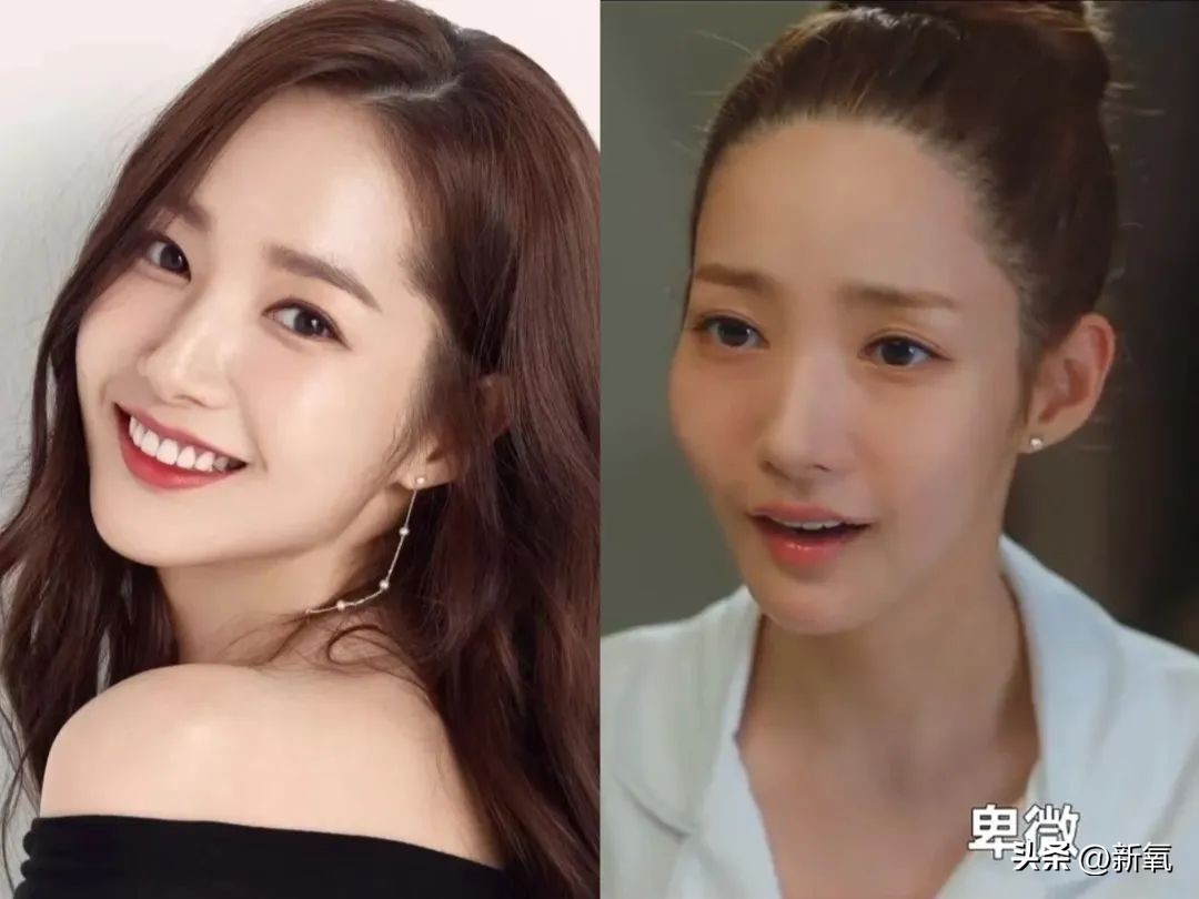 高颅顶怎么掩饰发际线,高颅顶会显得发际线低吗