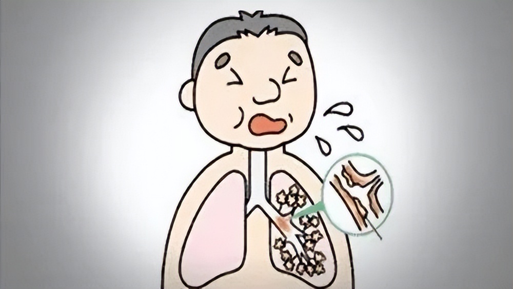 嗓子有痰咳不出来有什么小妙招,嗓子里老是有痰咳不出来怎么解决