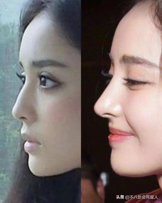 假头发假鼻子,假头发和假肚皮