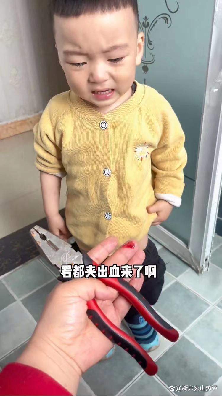 男童玩钳子不慎被夹伤上厕所,孩子满身被钳子夹伤