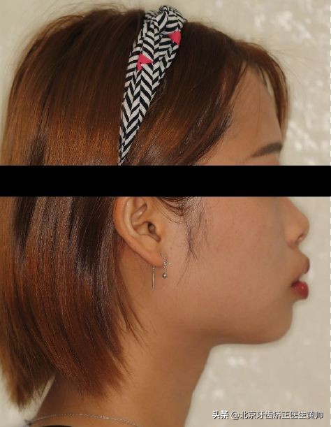 嘴凸的人怎么笑起来好看,嘴凸怎么让自己不焦虑