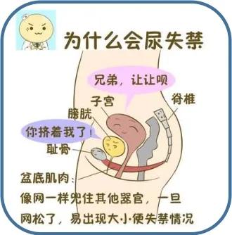 老年女性打喷嚏就漏尿,出门要穿纸尿裤,如何解决