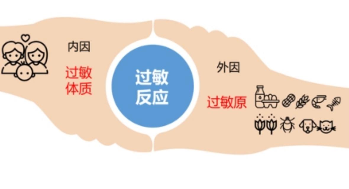 尘螨过敏脱敏治疗医保报销吗,尘螨1级过敏需要脱敏治疗吗