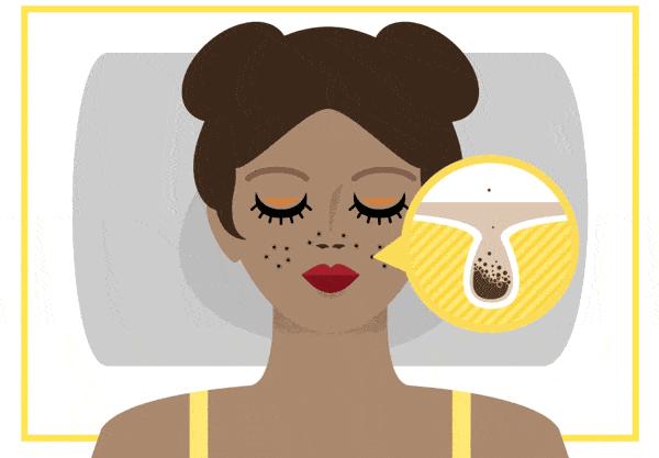 毛孔大到能插秧收敛只需这三步,毛孔粗到可以插秧该怎么自救