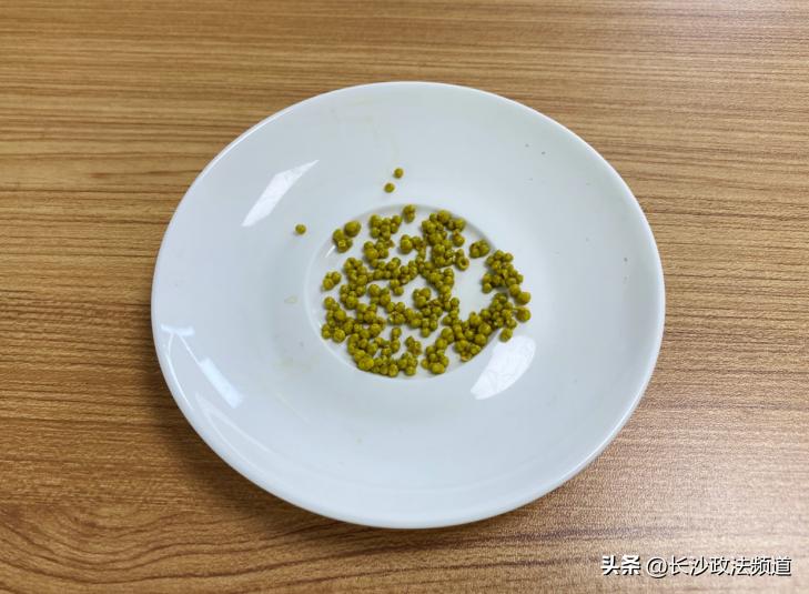 女子误把胆结石当胃病十余年,一女子胆里27颗胆结石