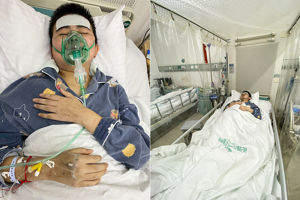 漂亮女孩患病,23岁女孩身体发生怪病