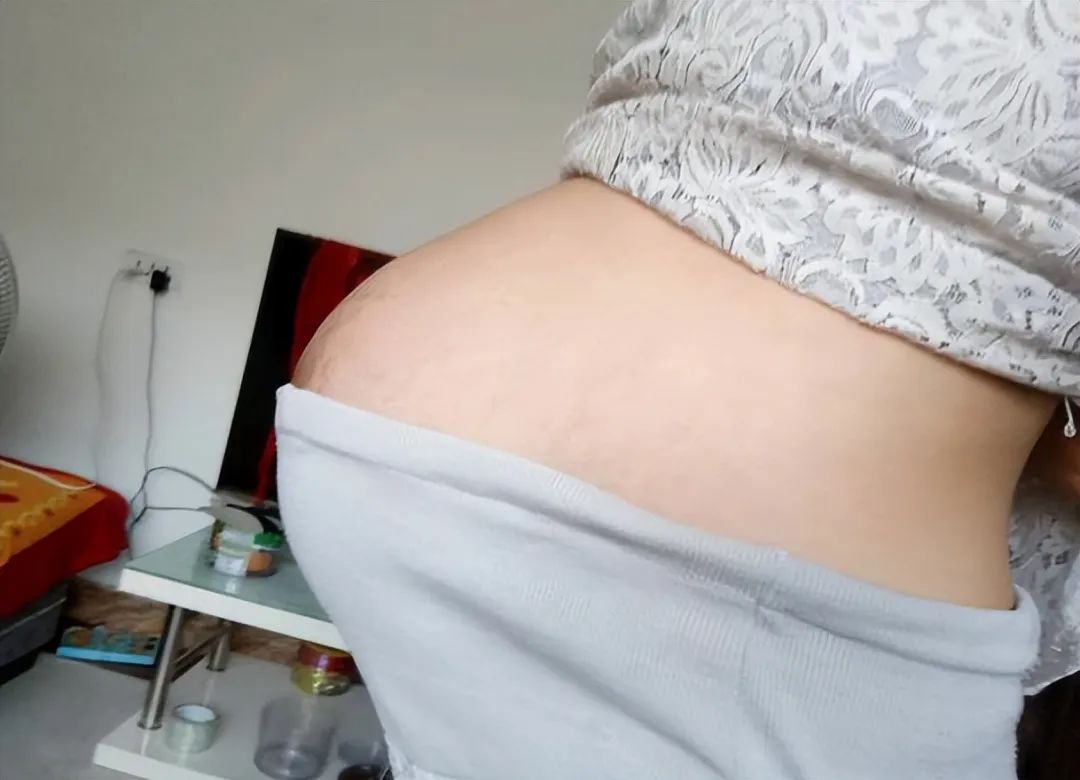 孕妈悬浮肚,孕妈露肚子晒太阳鼓包