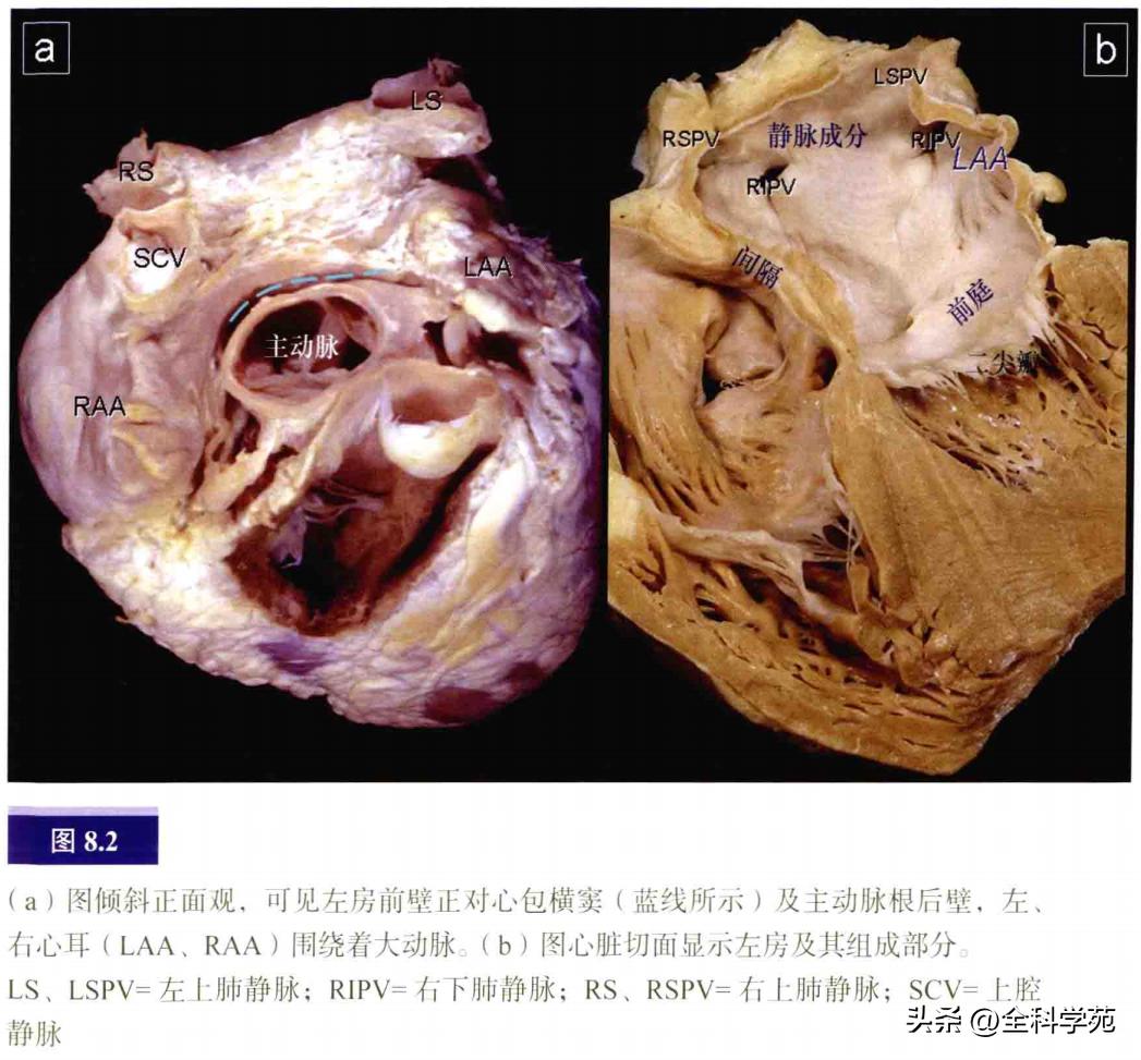 连接左心房的是肺静脉吗,左心房与肺静脉解剖
