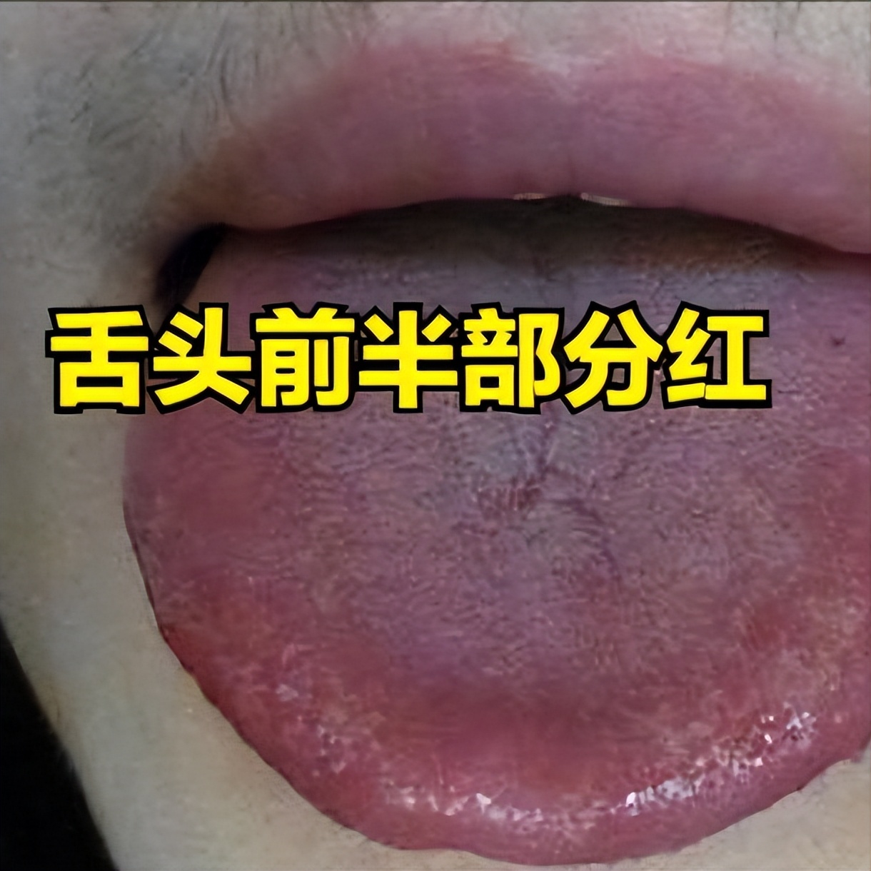 失眠舌头发涩是什么征兆,经常失眠舌苔白