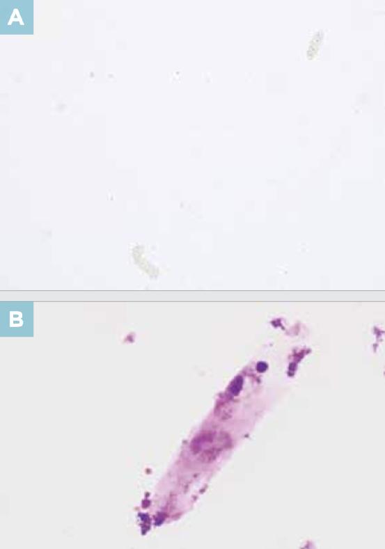 尿液干化学分析的实验原理,尿液标本采集操作