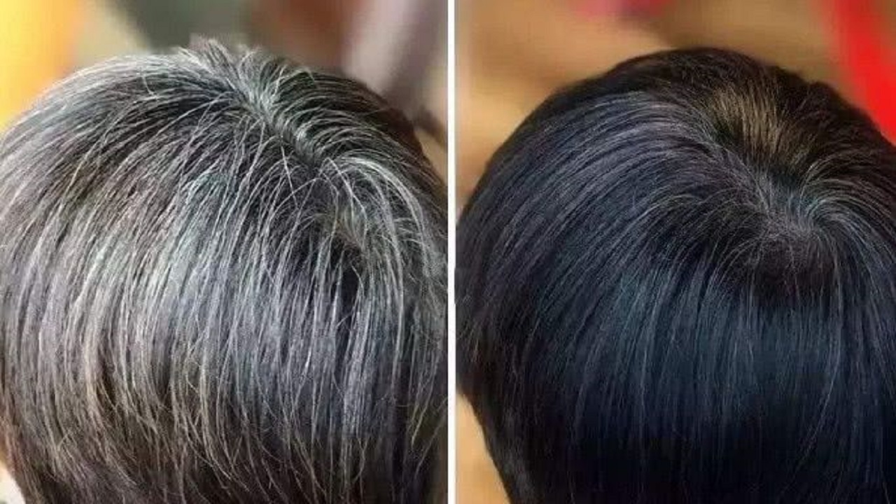 白头发越来越多是缺少什么营养吗,白头发越来越多缺少什么营养吗