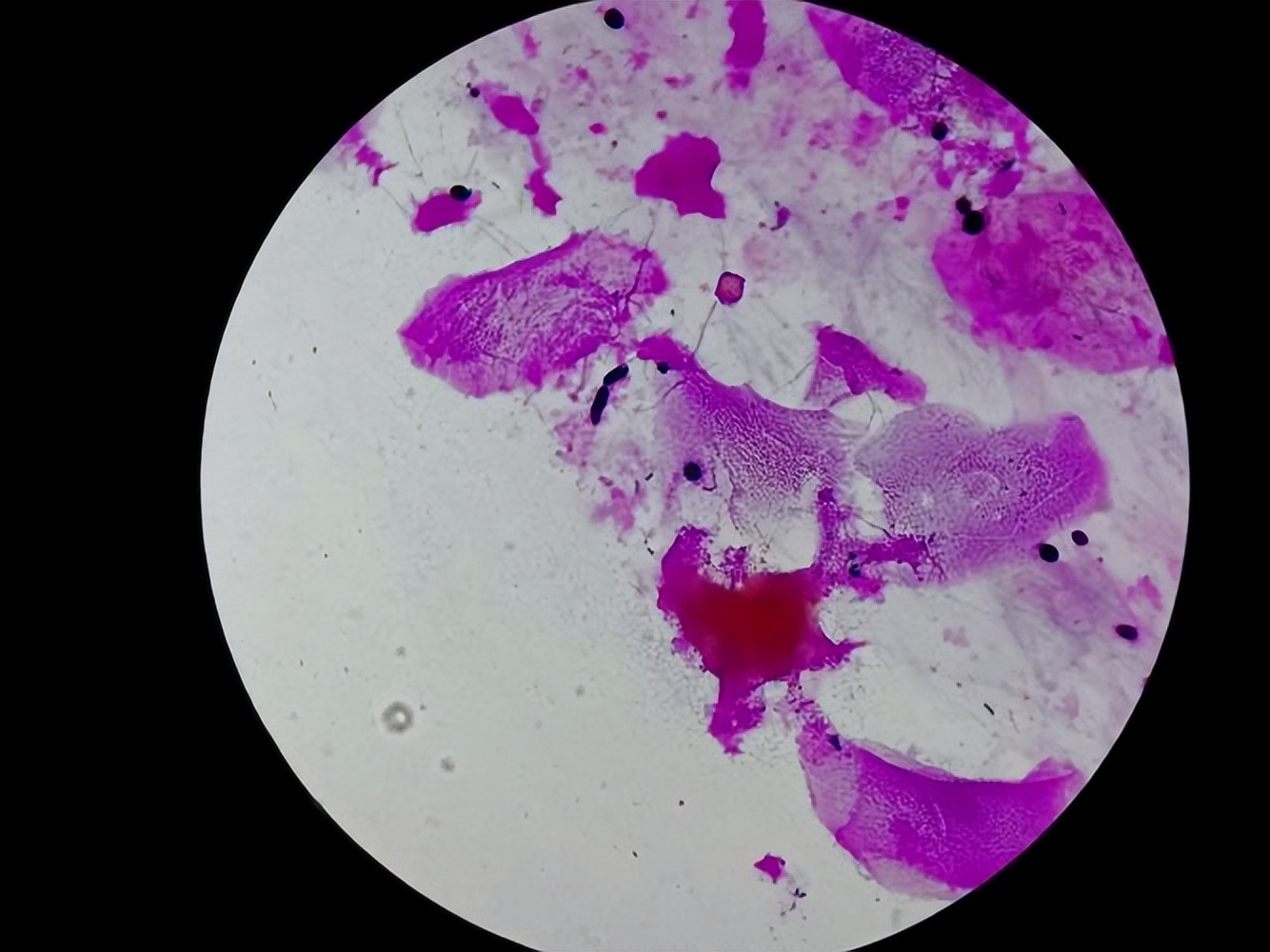 金黄色葡萄球菌的微生物特性,金黄色葡萄球菌的培养特性