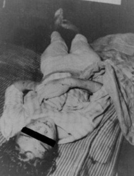 美国最残忍的虐待事件，16岁少女成人形家畜，身上留有150处伤口