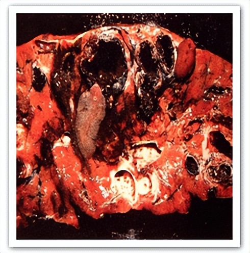 羊吸虫的防治方法,羊吸虫病有哪些特征