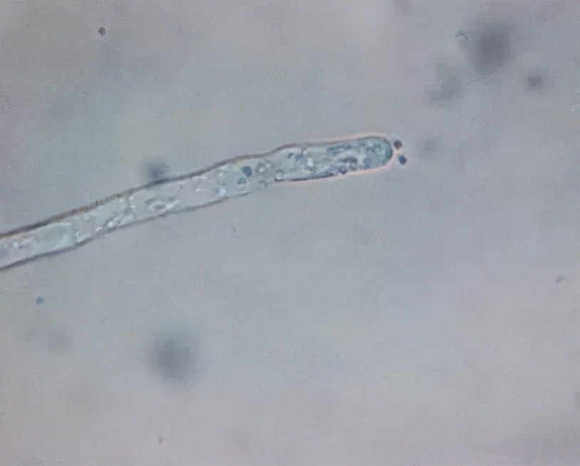 水产养殖霉菌怎么处理,水产养殖杀水霉方法