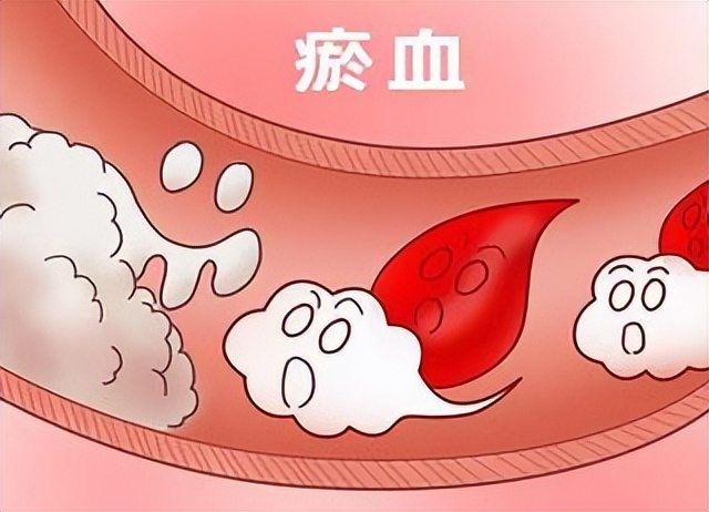 常腹痛拉肚子？光健脾可不行！一个妙方只三味药，扫清瘀浊止腹泻