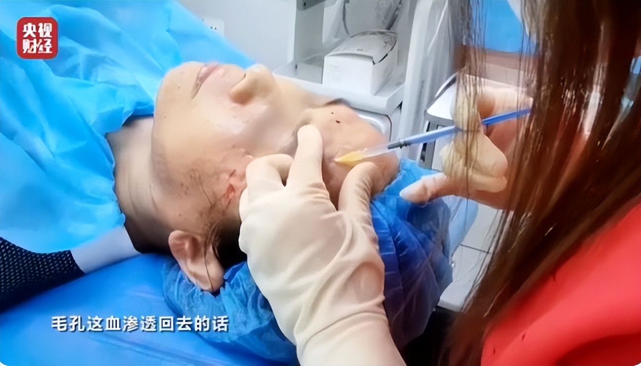 315曝光的瓜,315曝光茉莉泰国香米