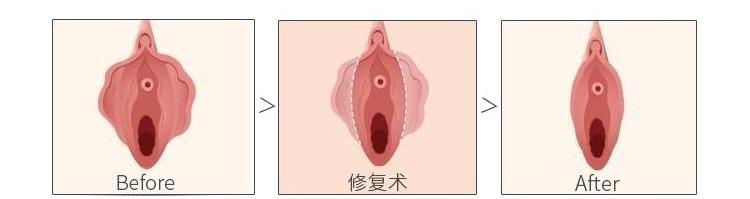 走路或骑车颠簸背上部疼痛,走路摩擦有疼痛感擦什么药