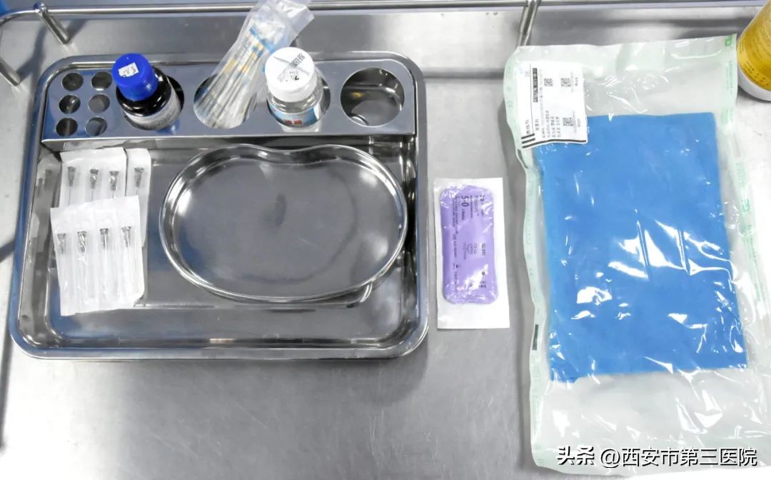 腹部穴位埋线减肥有效果吗,穴位埋线减肥一斤不减