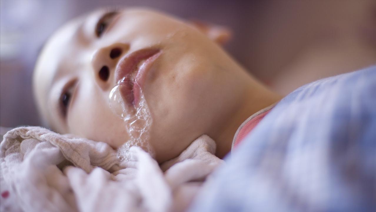 15岁男孩检查出脑肿瘤怎么办,小孩15岁胶质瘤前期的症状