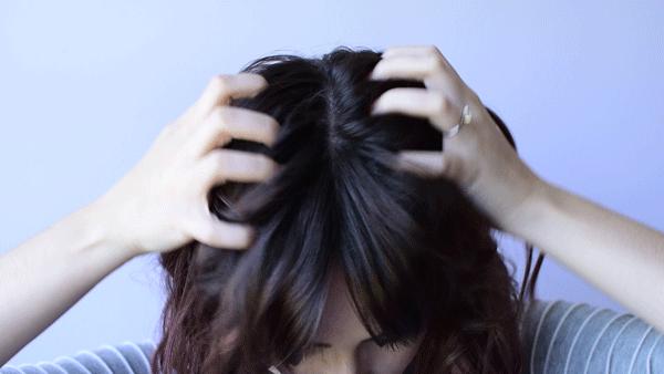 头屑多可能是脱发前兆,皮肤科医生头皮痒头屑多怎么解决