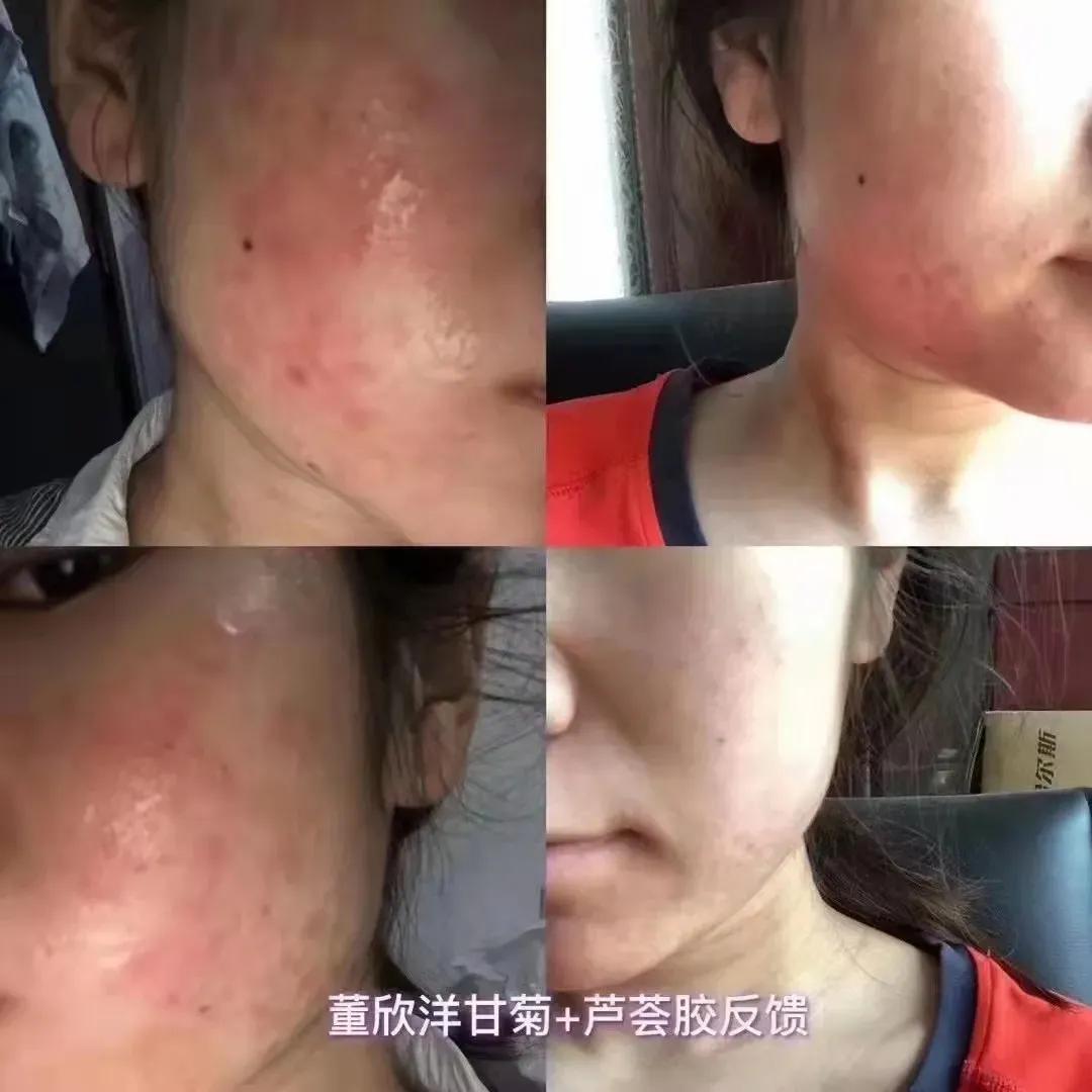 董欣护肤品哪个好用,董欣护肤品推荐