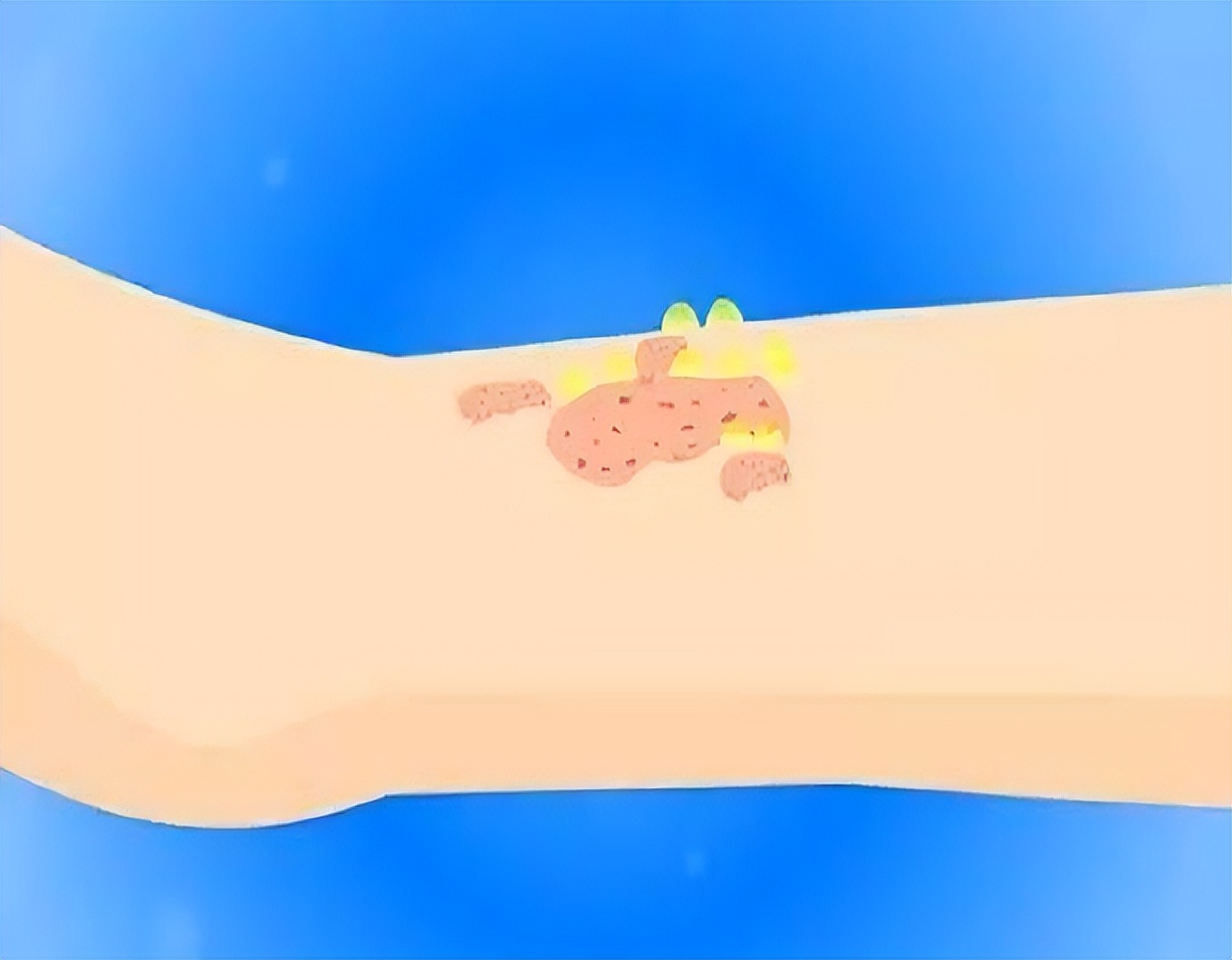 炉甘石万能药,万能止痒软膏配方